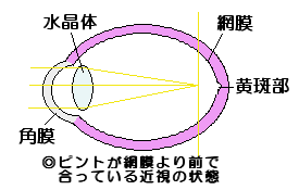 ߎ̖